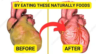 12 Amazing Foods to Avoid BLOOD CLOTS, HEART ATTACK & STROKE | Naturally | EW