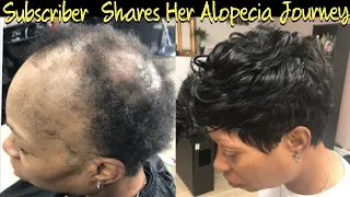 Severe Alopecia Sew In | Subscriber Free Transformation ( Listen to her Alopecia Journey)