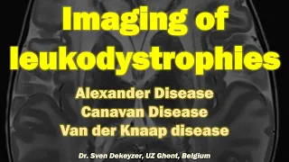 Imaging of Leukodystrophies (part 1): Alexander disease, Canavan disease and Van Der Knaap Disease