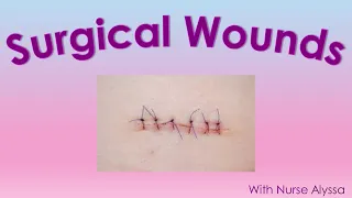 Surgical wounds