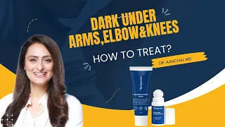 Dark underarms, elbows and knees | How to treat | Dermatologist recommends | Be Bodywise Review