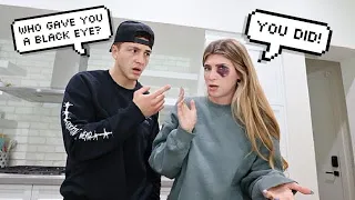 My Husband Gave Me a Black Eye Prank *Cute Reaction*