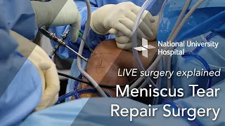 LIVE Surgery Explained: Meniscus Tear Surgery