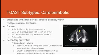 NFTNN Post-Stroke Workup and Stroke Etiologies Part 1