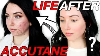 Was it Worth it?! 6 Months POST-ACCUTANE | Lasting Side Effects, Scarring, Breakouts Coming Back?!