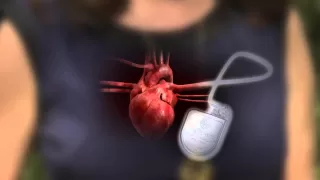 Defibrillator-Pacemaker: What's the Difference?