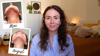 Akne Q&A » Isotretinoin Erfahrungen, vegane Ernährung & meine Haut am Tag der Hochzeit