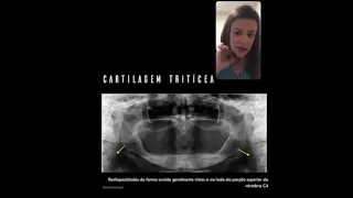 Calcificações Tecidos Moles