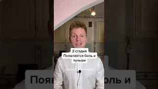 Что делать если человек получил ожог?