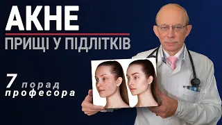 Акне прищі, вугрі на обличчі у підлітків - причини, лікування в домашніх умовах без антибіотиків