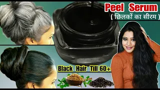 Black Hair Till Age 60+:Use Peels (छिलका) Serum To Make Premature White Hairs Black ।Garima Singh ।