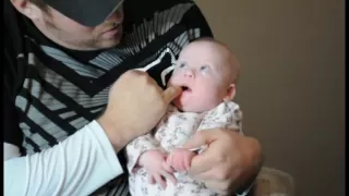 Oral Exercises for Babies with Down Syndrome