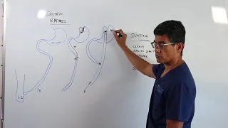 What is the Gastric Bypass Procedure? - Dr. Mario del Pino