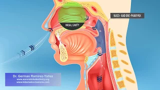 Mouth Breathing in Children from Dr. German Ramirez