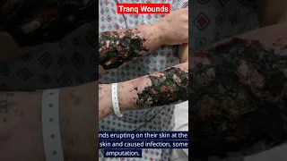 😮Tranq Wounds can Lead to Rotting Skin and Amputation