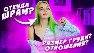 ОТКУДА У МЕНЯ ШРАМ?! Как размер груди влияет на отношения?! ВОПРОС-ОТВЕТ