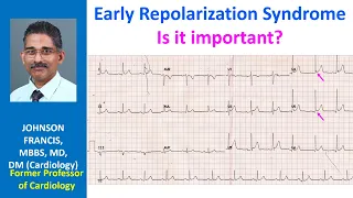 Early Repolarization Syndrome: Is it important?