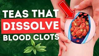 10 Teas That Prevent and Dissolve Blood Clots