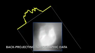 Simulated demonstration of X-ray tomography of human head