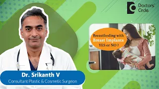 Can I Breastfeed After a Breast Augmentation? #breastimplants  - Dr. Srikanth V | Doctors' Circle