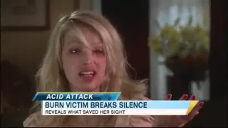 Acid Attack Victim Speaks