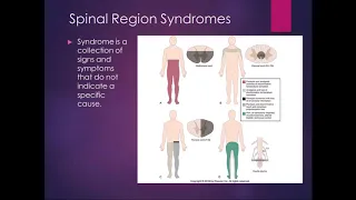 Chapter 18 Lecture Part 2 Spinal Cord Dysfunction