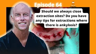 Ep 64 - Should we always close extraction sites?