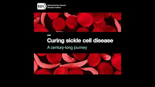Curing sickle cell disease: A century-long journey