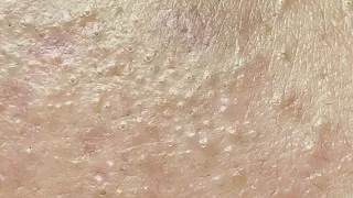 Satisfying Relaxing with Sac Dep Spa Video (#210)