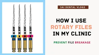 HOW I USE ROTARY RCT FILES IN MY CLINIC | PREVENT FILE BREAKAGE