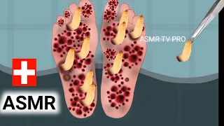 ASMR Remove dog ticks and deep cleaning maggots infected leg injured | 2d animation