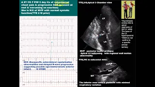 2 Test your skill Echo case study ACS