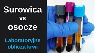 Serum and plasma - properties and differences. Does choice matter?