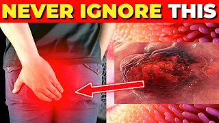 Critical Colon Cancer Symptoms You Should Never Ignore