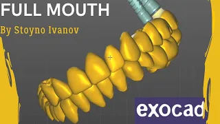 Fastest Exocad Video Tutorial - Veneers / Crowns / Bridges / Implants / Custom Abutments