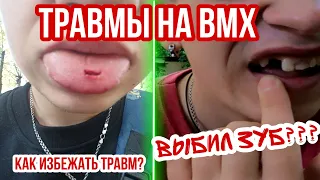 Как я выбил зуб катаясь на BMX? О травмах/ Выбил зуб/ прокусил язык/ травмировался на БМХ