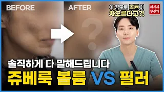 쥬베룩 키닥터 선정 기념!✨  쥬베룩 볼륨(레니스나) vs 필러 완전 솔직하게 비교🎈해드립니다.