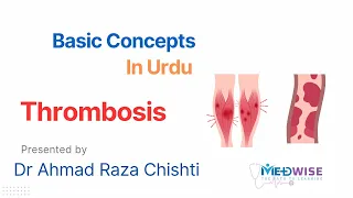 Thrombosis | Mechanism