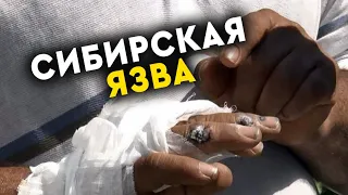 Сибирская язва появилась в Дагестане