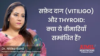 Vitiligo And Thyroid: Is There A Connection Between These Diseases? #safeddaag #vitiligo #thyroid