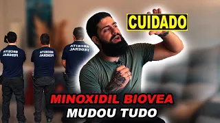 IMPORTAÇÃO MINOXIDIL BIOVEA - CUIDADO, MUDOU TUDO | BARBA PRETA