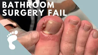 MEGA INGROWN REMOVAL