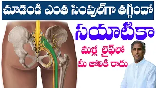 What You Need to Know About Sciatica ? | Sciatica Stretches | Dr Manthena Satyanarayana Raju Videos