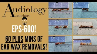 60 + MINUTES OF EAR WAX REMOVALS - EP600