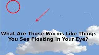 What Are Those Strange Things Floating In Your Eye? | Eye Floaters the worm that drifts across eyes.