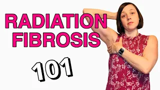 Radiation Fibrosis Side Effect - What You Need to Know