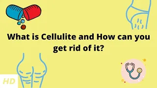 What is Cellulite and How can you get rid of it?