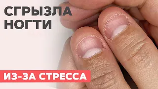 Extension on BITTEN nails | How to fix such nails?