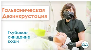 Дезинкрустация | Чистка лица | Глубокое очищение