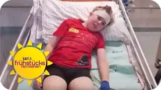 So TAPFER geht MAURICE (12) mit seinem GEHIRNTUMOR um | SAT.1 Frühstücksfernsehen | TV